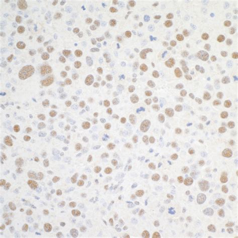 BRD4 Polyclonal Antibody (A301.